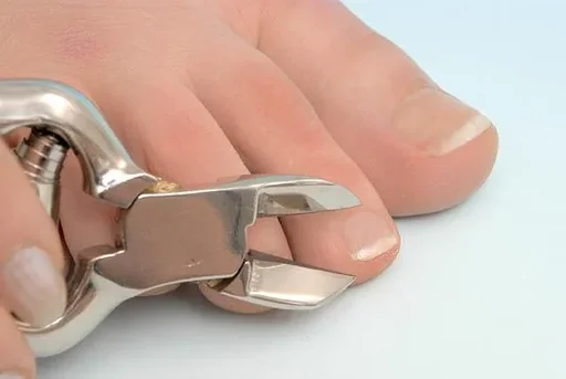 "Nail clippers, extra sharp - for well-groomed nails image"